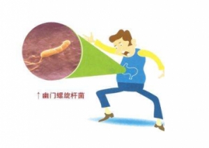 幽门螺杆菌如何根治 幽门螺杆菌的危害