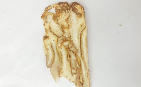 脱发怎么办 脱发吃什么中药好 脱发如何预防