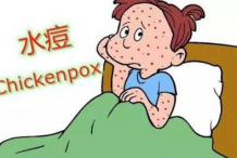 孩子出水痘要注意这些常见误区