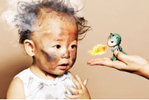 幼儿烧伤知多少