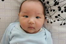 小孩子斗鸡眼的出现原因及预防办法