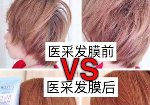 医采发膜适合什么发质 多少钱一瓶