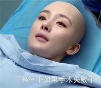 杨幂光头造型 翻译官乔菲得脑海绵状血管瘤