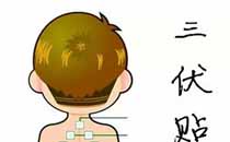 三伏贴每个小孩能贴吗 儿童贴三伏贴要注意些什么